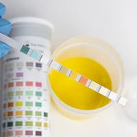 At-Home urine Pregnancy Self-Test (Midstream Kit)